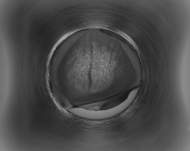 X0000084571144200703231815