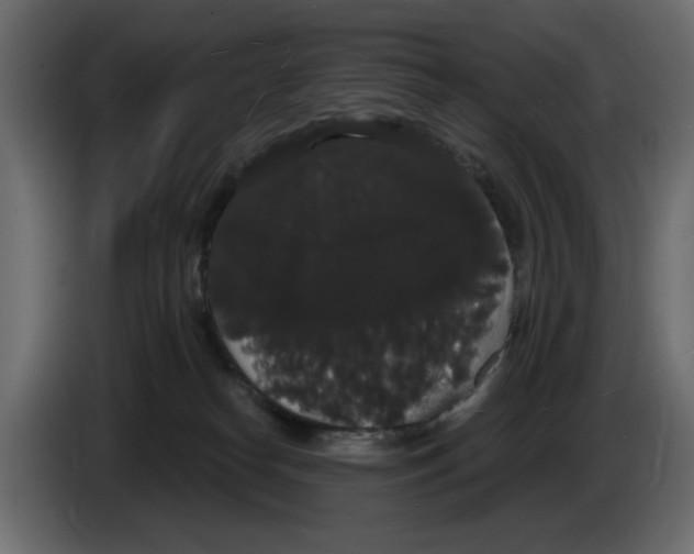 X0000084580182200703231851