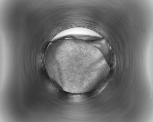 X0000084600237200703161824