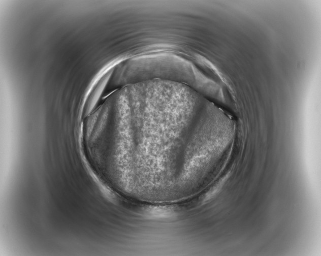 X0000084601418200703161810