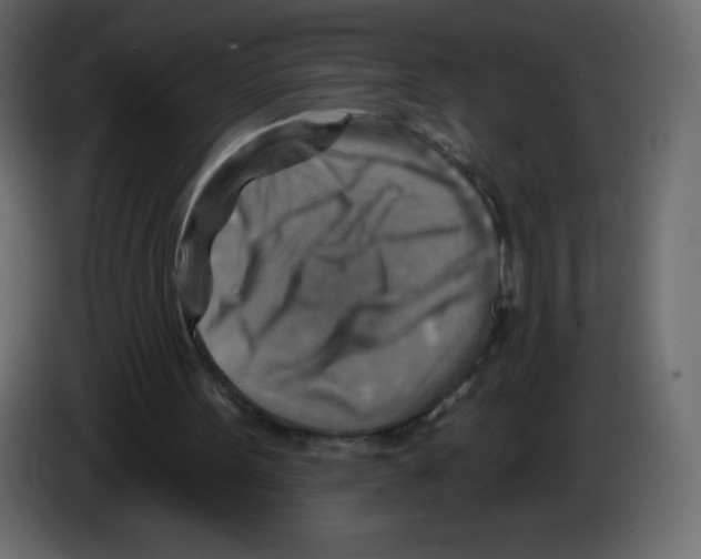 X0000084600099200703231935