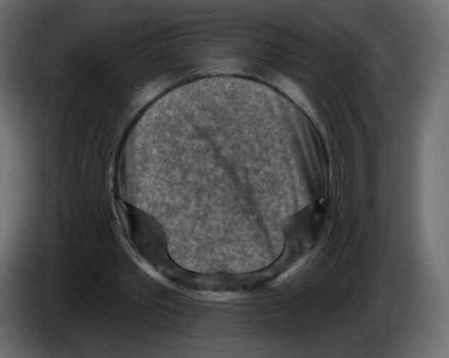 X0000084600389200703231931