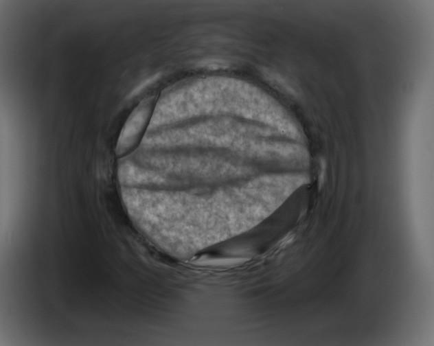 X0000084601158200703231920