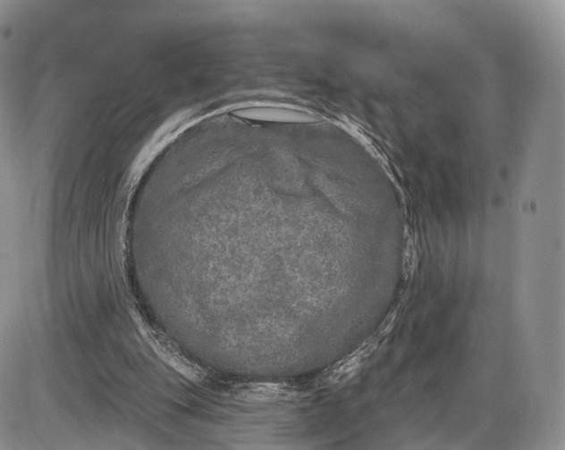 X0000085000151200703191059