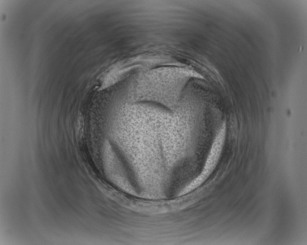 X0000085000029200703261140