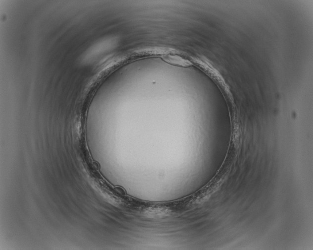 X0000085000063200703261139