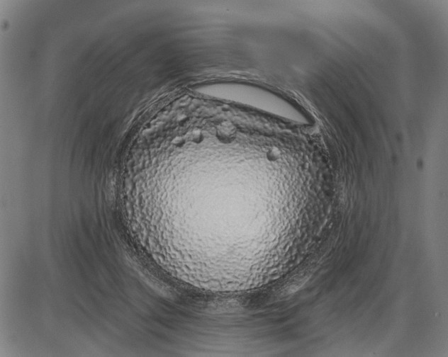 X0000085000357200703261135