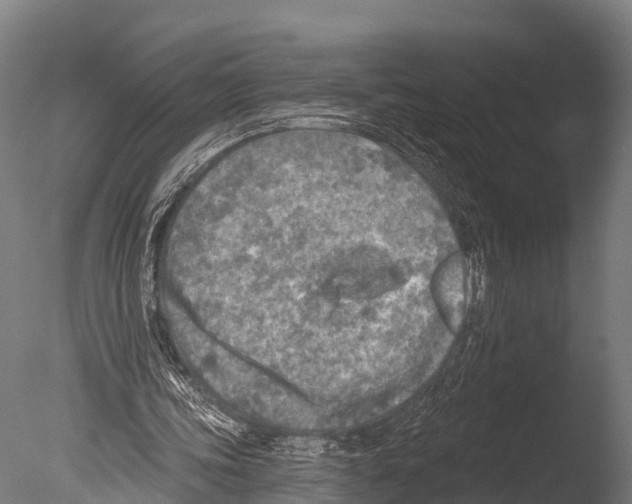 X0000085000339200704021339