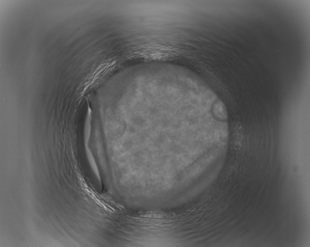 X0000085000738200704021333