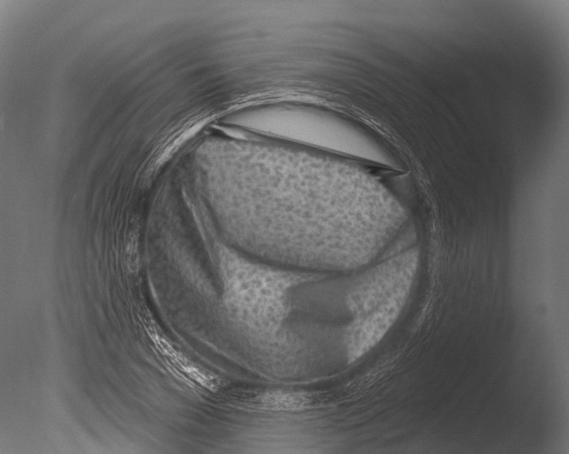 X0000085000977200704021329