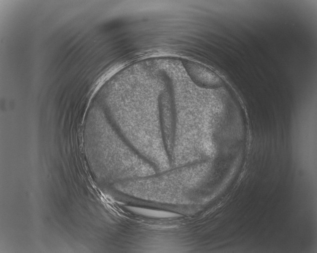 X0000085001145200704021327