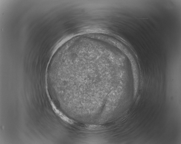 X0000085001439200704021322