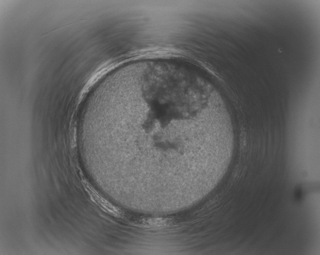 X0000085001459200704021321