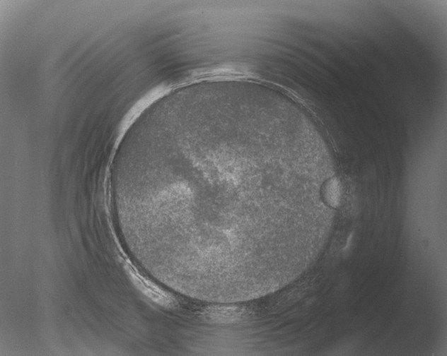 X0000085001474200704021320