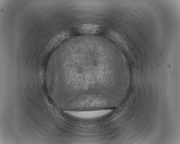X0000085010641200703191116