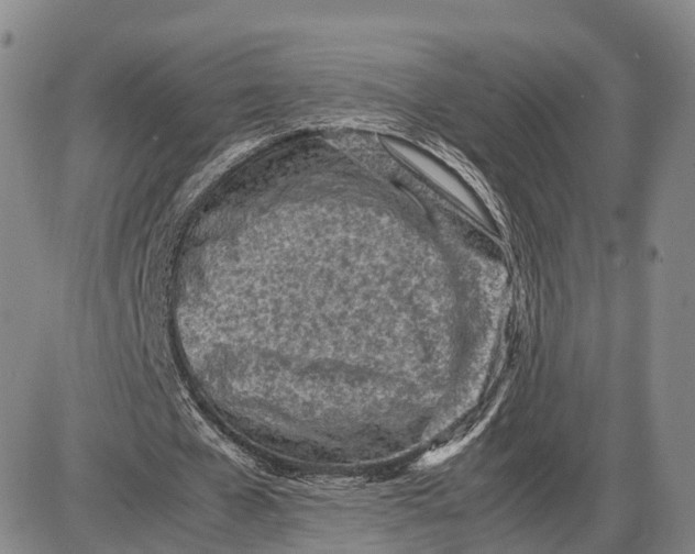 X0000085010577200703261157