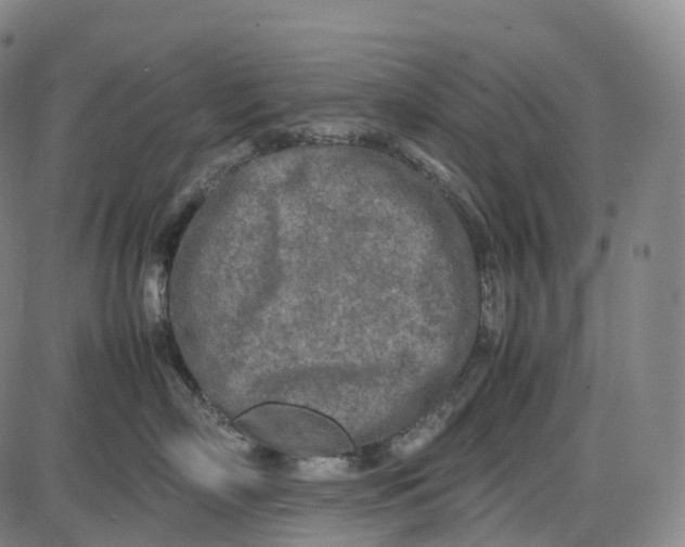 X0000085010718200703261155