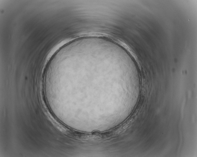 X0000085011187200703261147