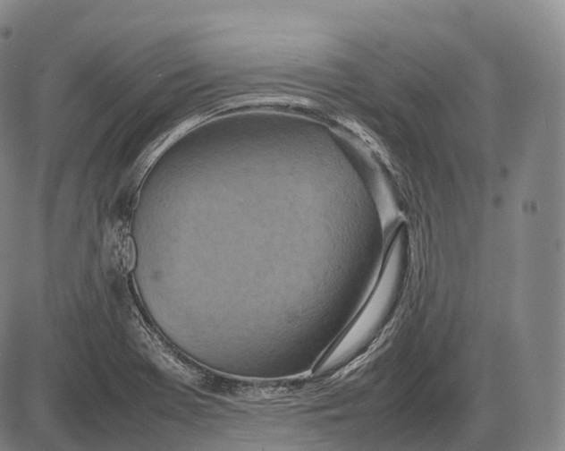 X0000085011369200703261144