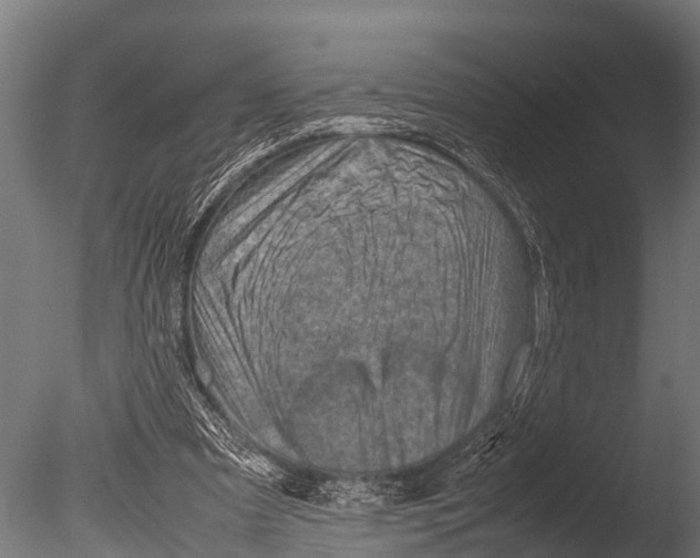X0000085010297200704021408
