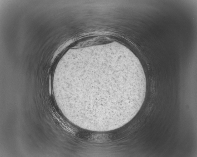 X0000085011171200704021352