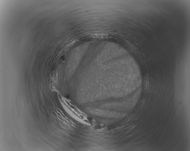 X0000085011202200704021351