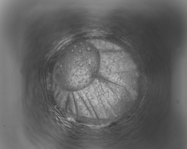 X0000085011399200704021348