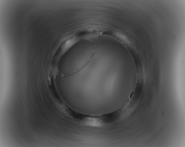 X0000085020167200703121550