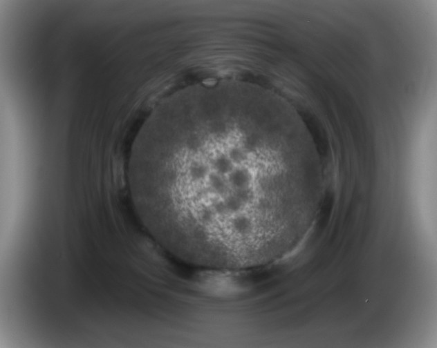 X0000085020182200703121550
