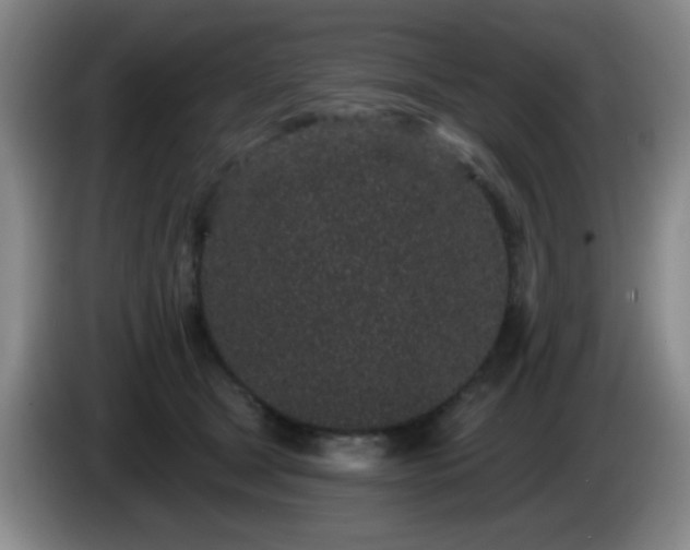 X0000085020465200703121546
