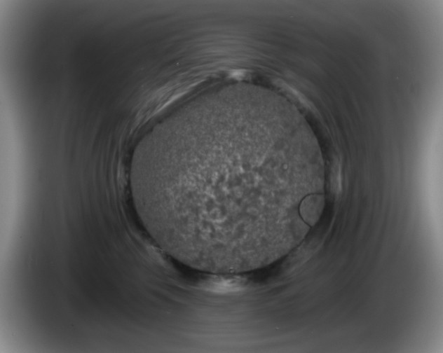 X0000085020569200703121545