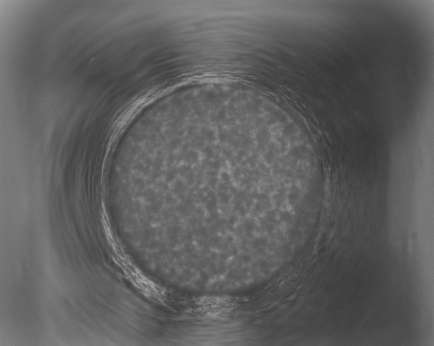 X0000085020145200704021436