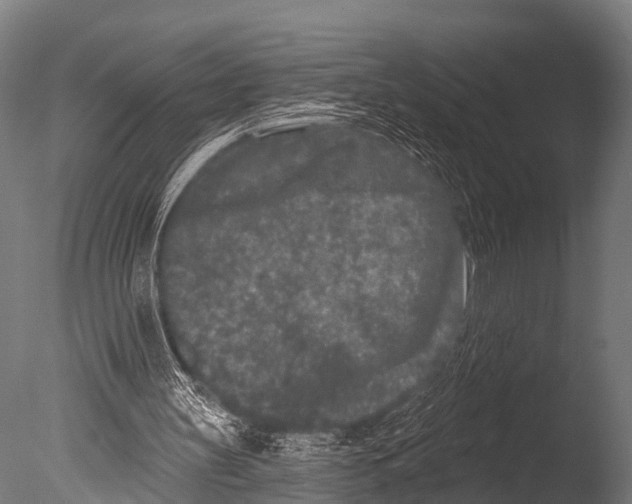 X0000085020147200704021436