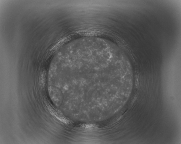 X0000085020165200704021437