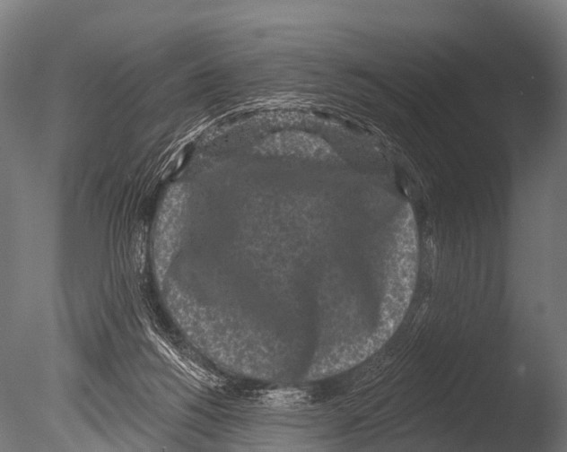 X0000085020168200704021437