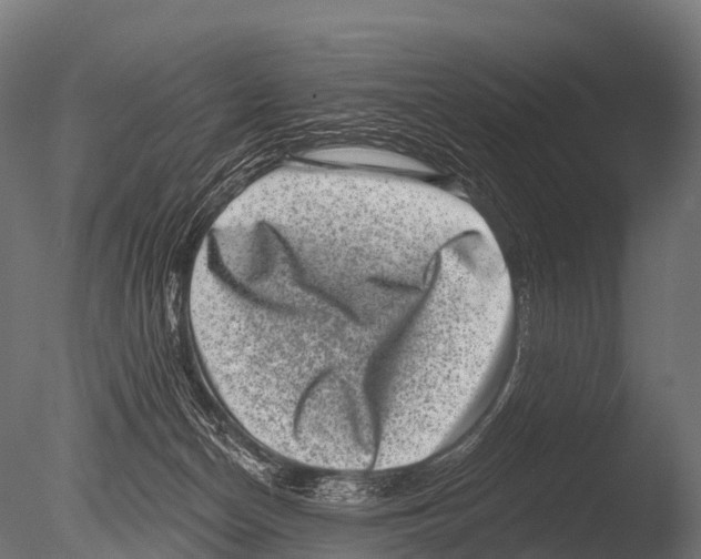 X0000085020174200704021437