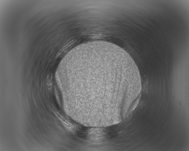 X0000085020179200704021437