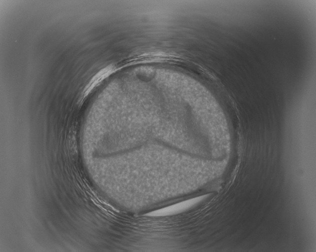 X0000085021259200704021418