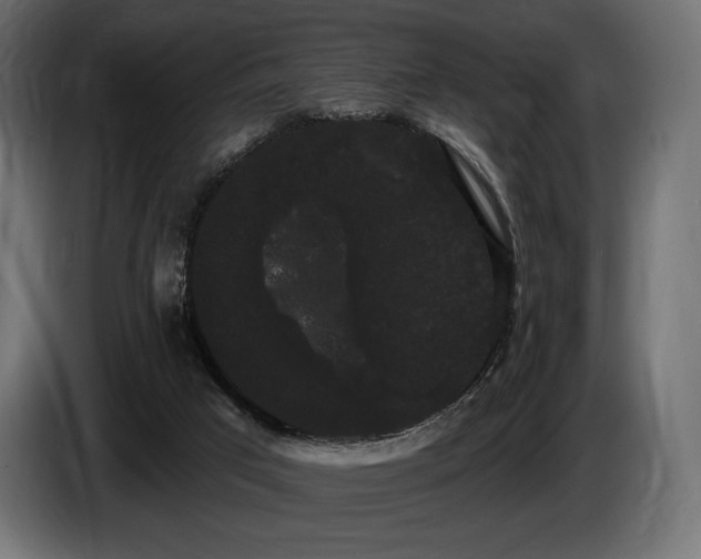 X0000085040017200703051402