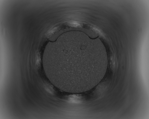X0000085050320200703051423