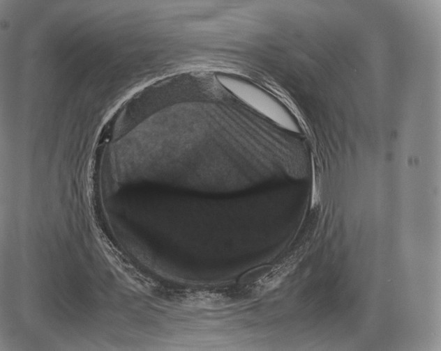 X0000085050387200704021325