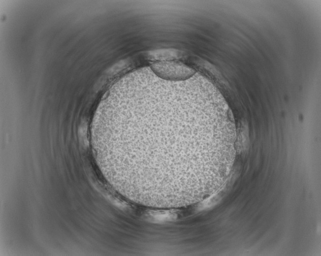 X0000085070187200704021420