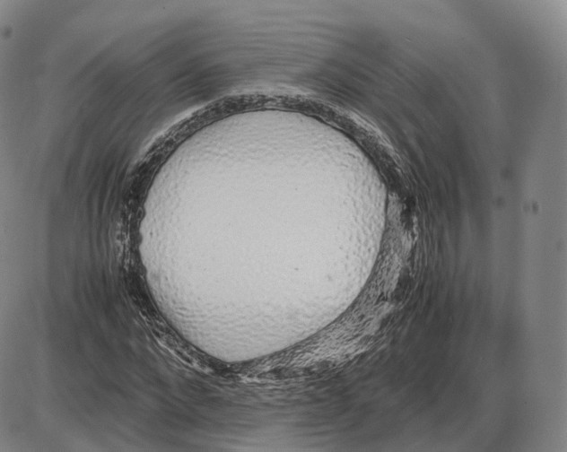 X0000085070872200704021408