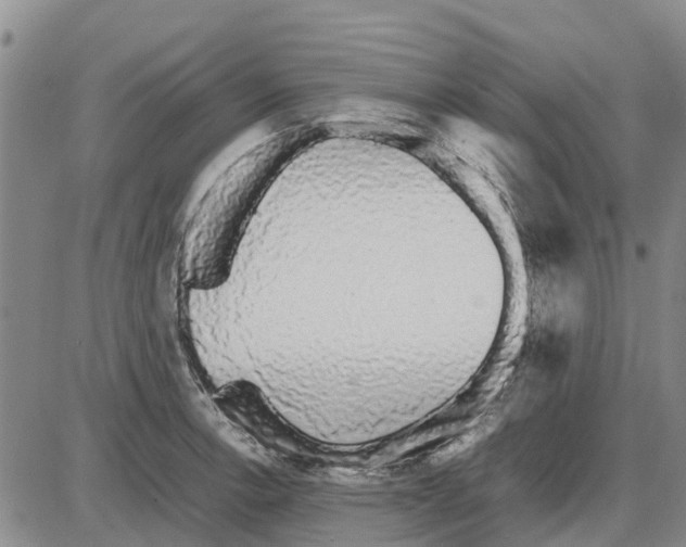 X0000085071138200704021404