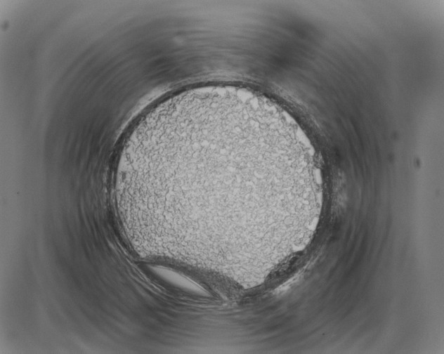 X0000085071170200704021403