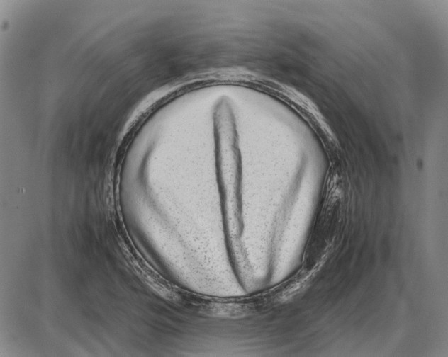 X0000085071176200704021403