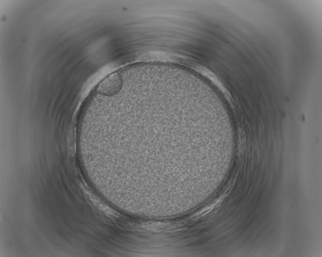 X0000085081075200704021431