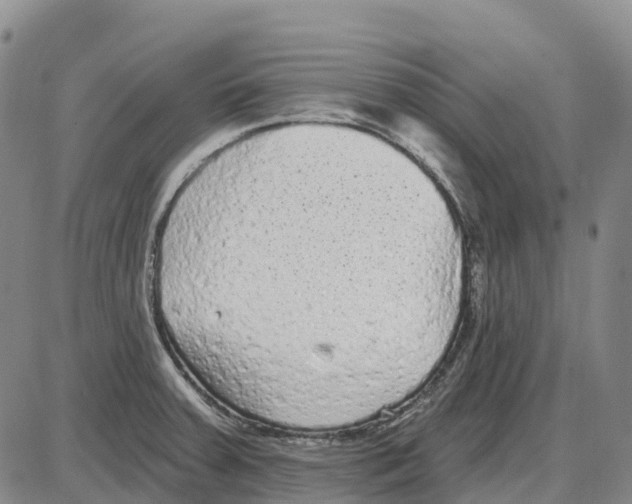 X0000085081379200704021425