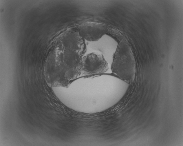 X0000085211397200703090817