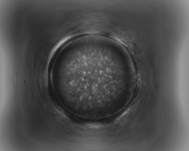 X0000085210200200703091146
